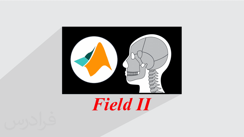 آموزش پردازش تصاویر پزشکی اولتراسوند و بهبود کیفیت در متلب با Field II