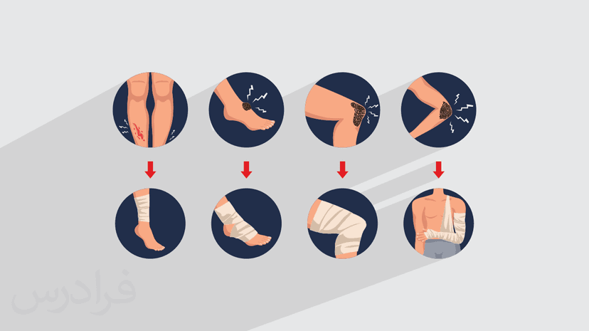 آموزش آشنایی با انواع زخم و روش پانسمان آن
