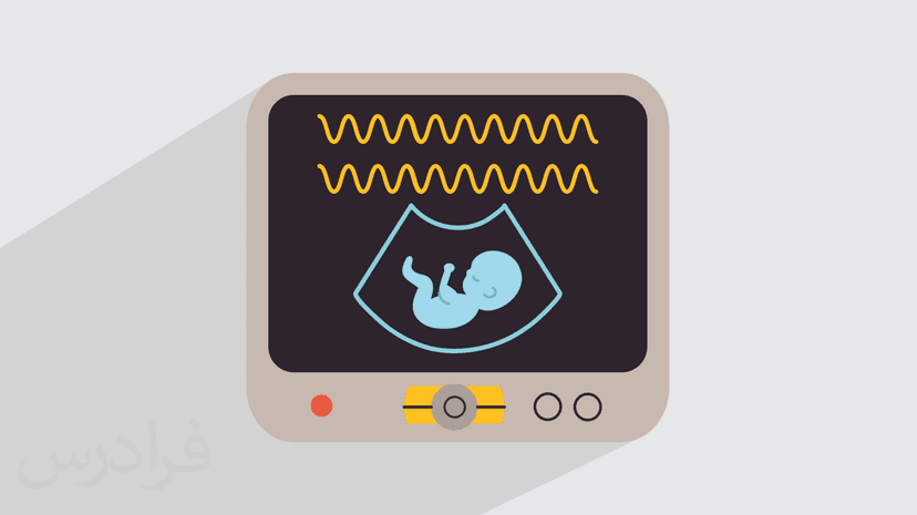 آموزش تفسیر نوار قلب جنین NST