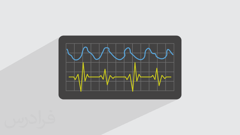 آموزش پردازش سیگنال های پزشکی – پیش ثبت نام